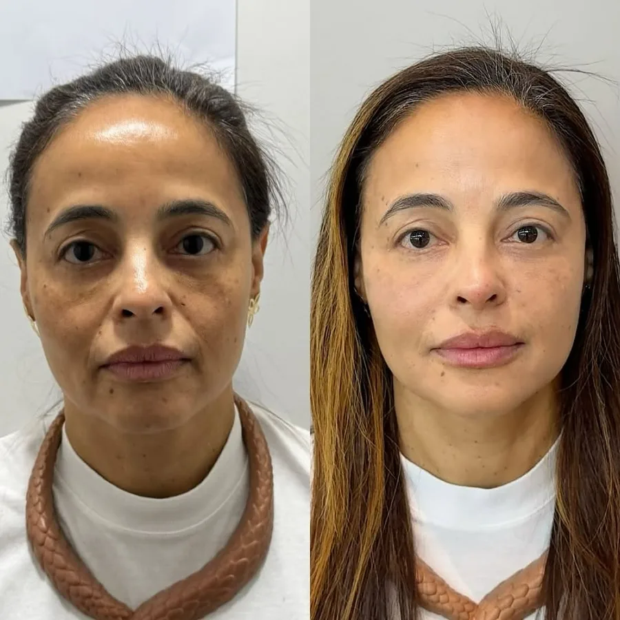 Resultado Dra. Bela